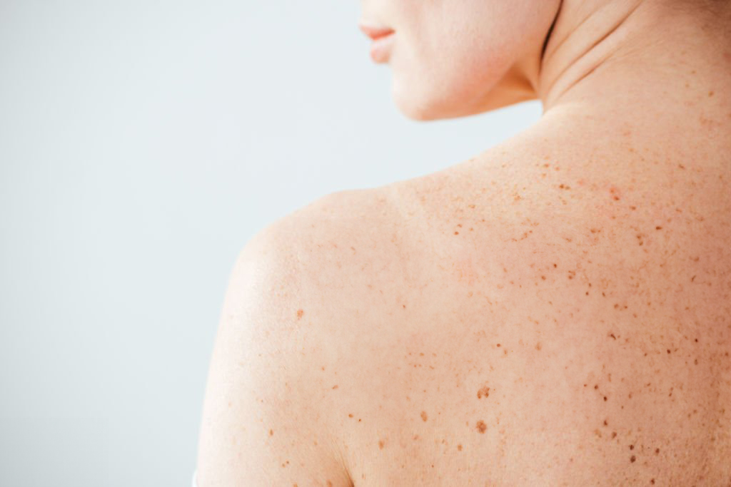 Piel sensible: qué es y cómo reconocerla